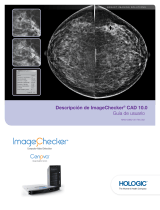 HologicUnderstanding ImageChecker CAD 10.0